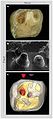 Thumbnail for version as of 19:44, 19 September 2010